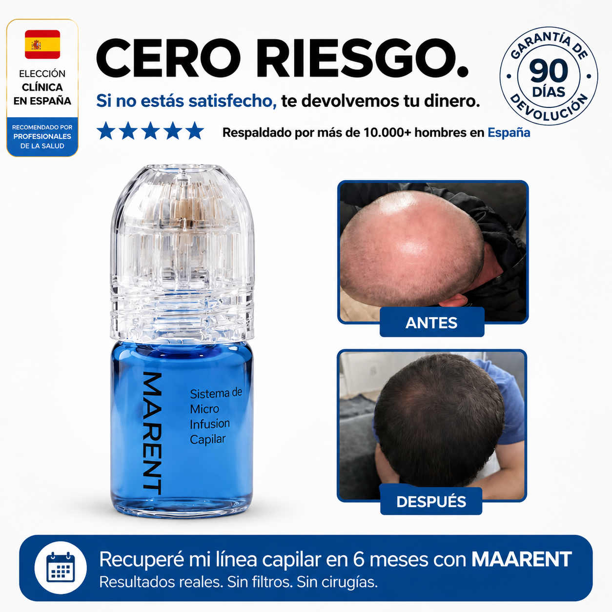 EL SISTEMA DE MICROINFUSIÓN CAPILAR MÁS AVANZADO.